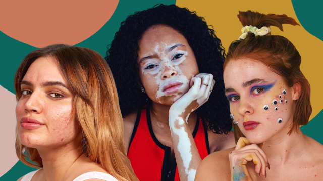 skin positive influencers