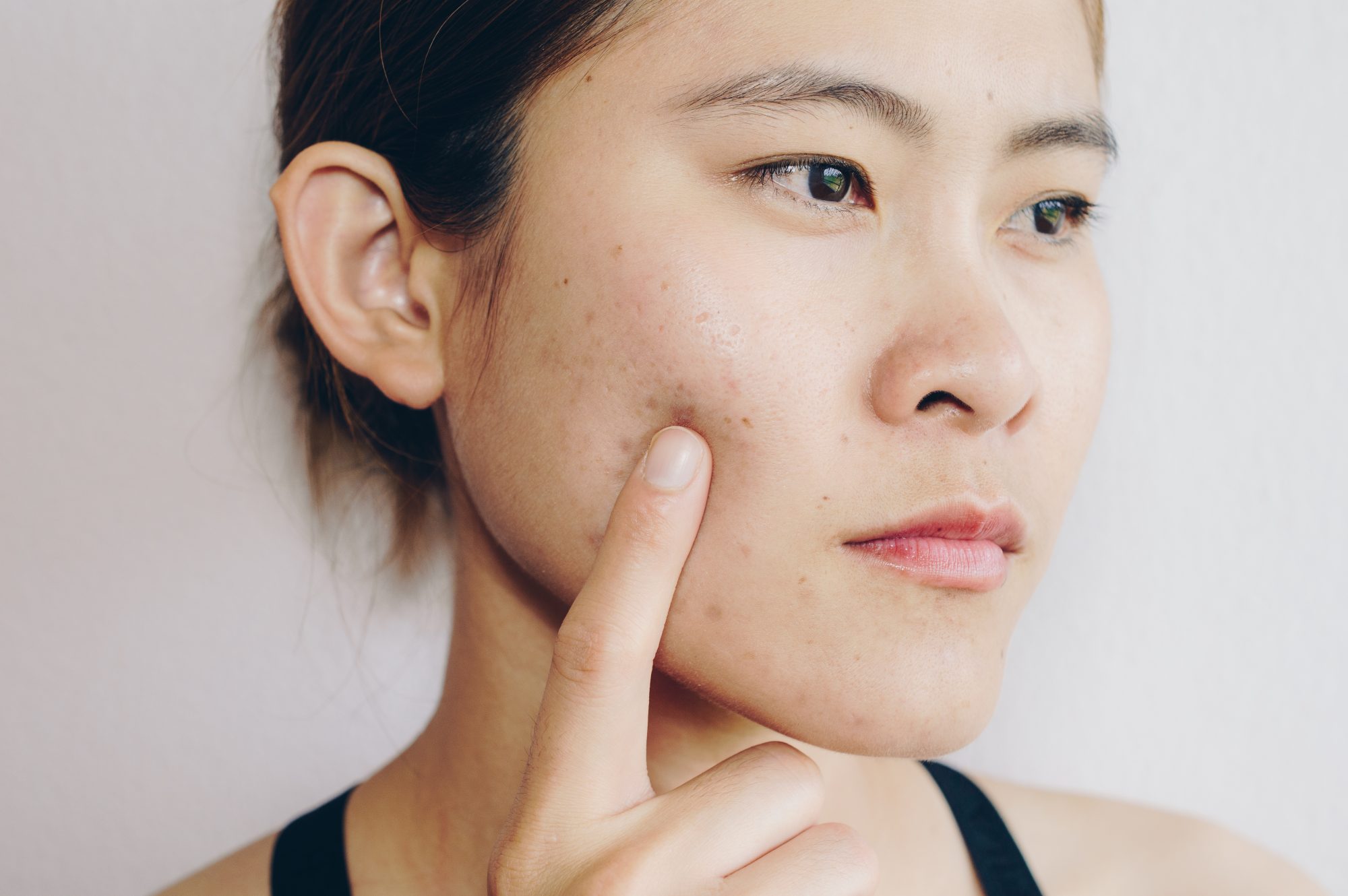 skin health signs