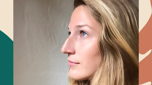 bumpy nose confidence merissa principe hellogiggles