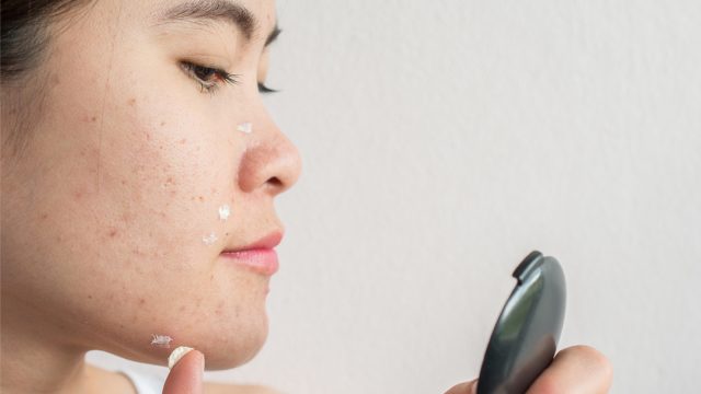 What Is Benzoyl Peroxide and How Should You Use It?HelloGiggles