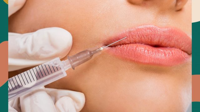 lip injections