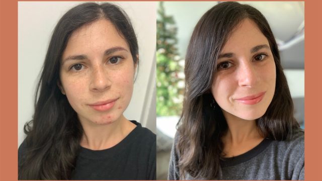 Rachel-Before-After