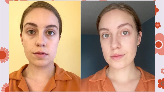Skyn Iceland Dissolving Microneedle Eye Patches review before/after