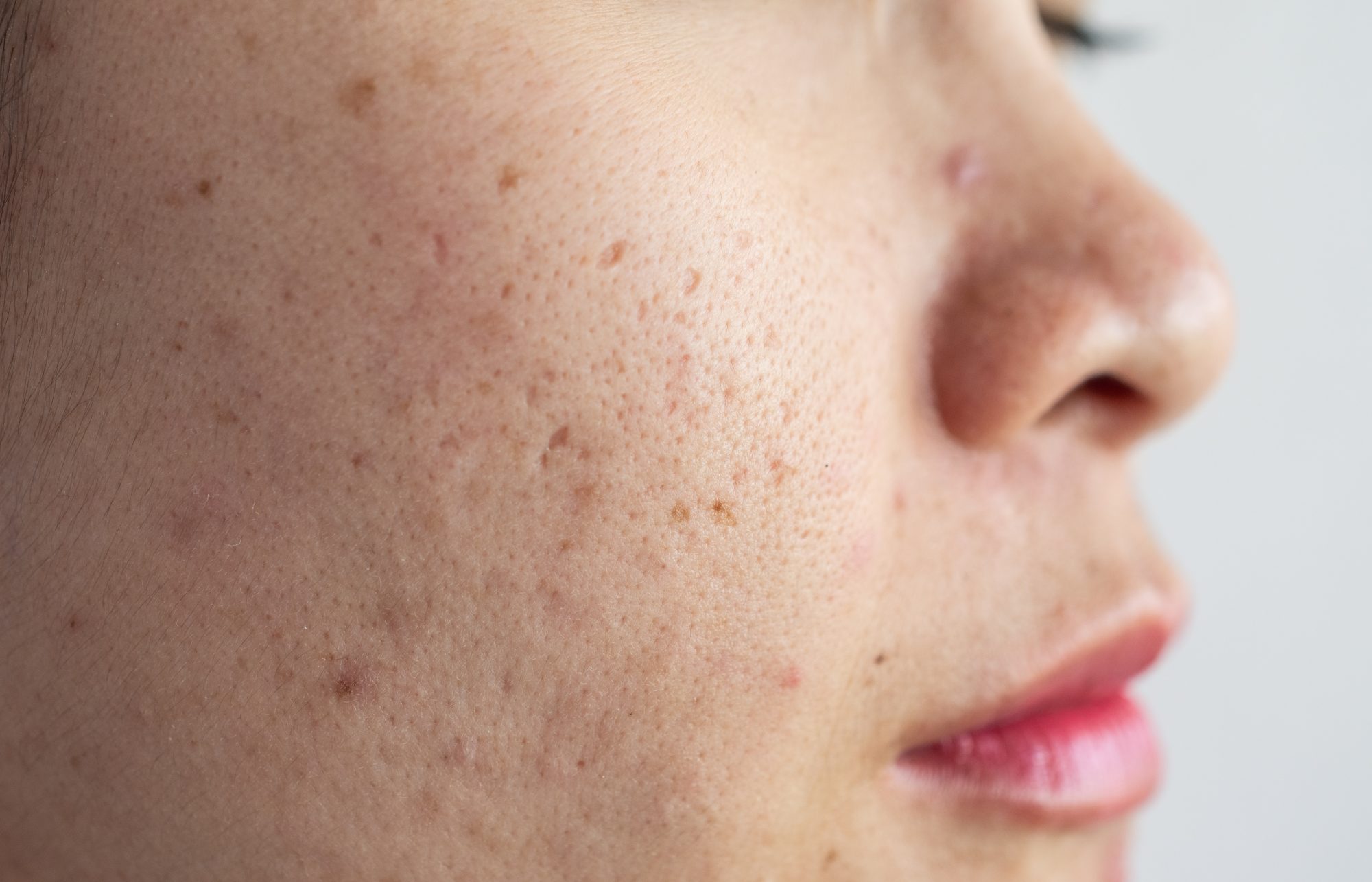 how to heal scars