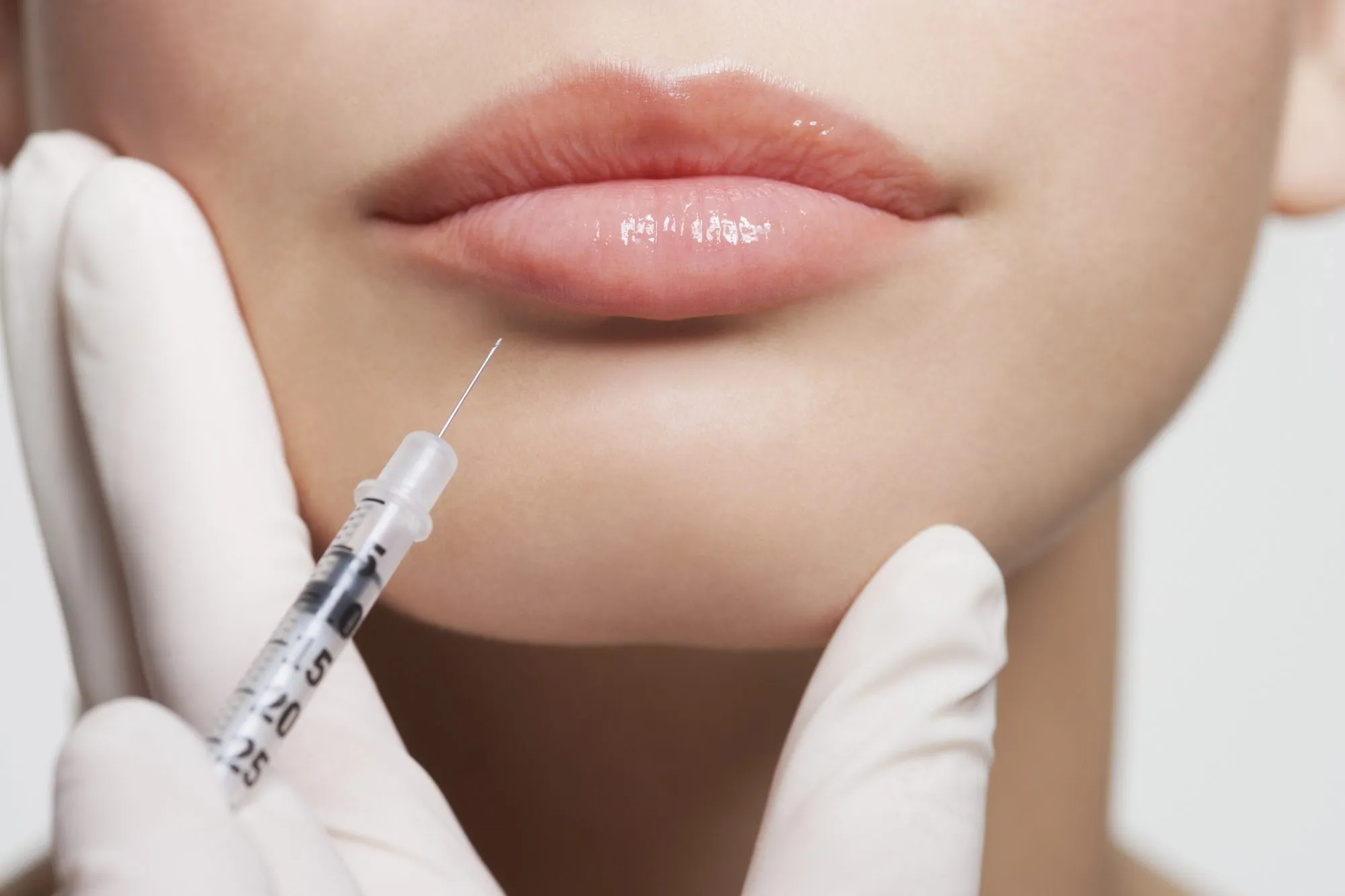 cosmetic infidelity botox fillers