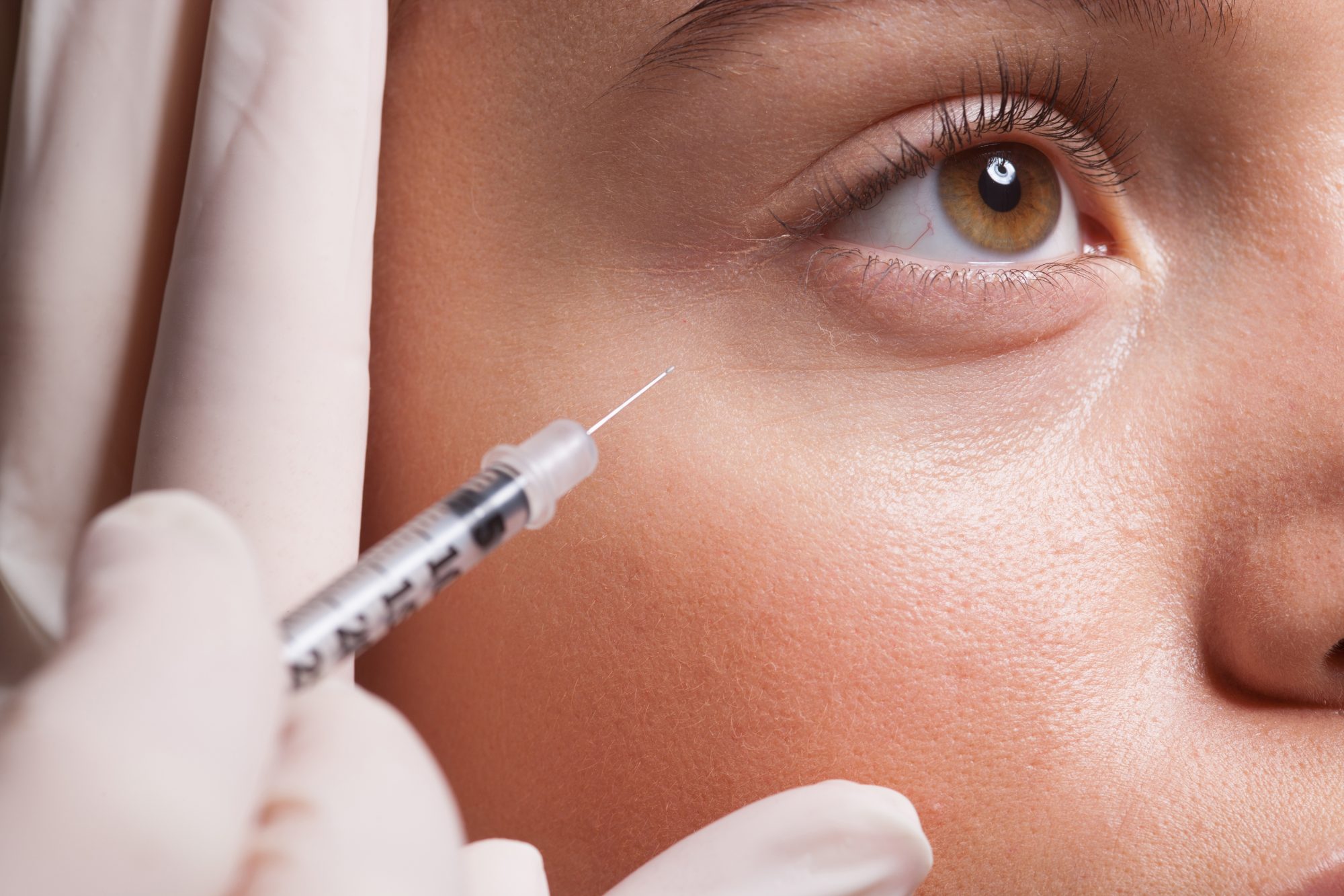 cosmetic infidelity botox fillers