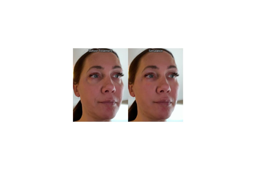 Before after of jene