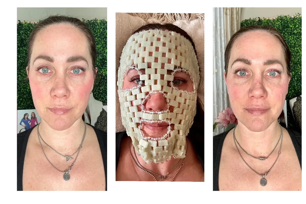 Jade-mask-before-after