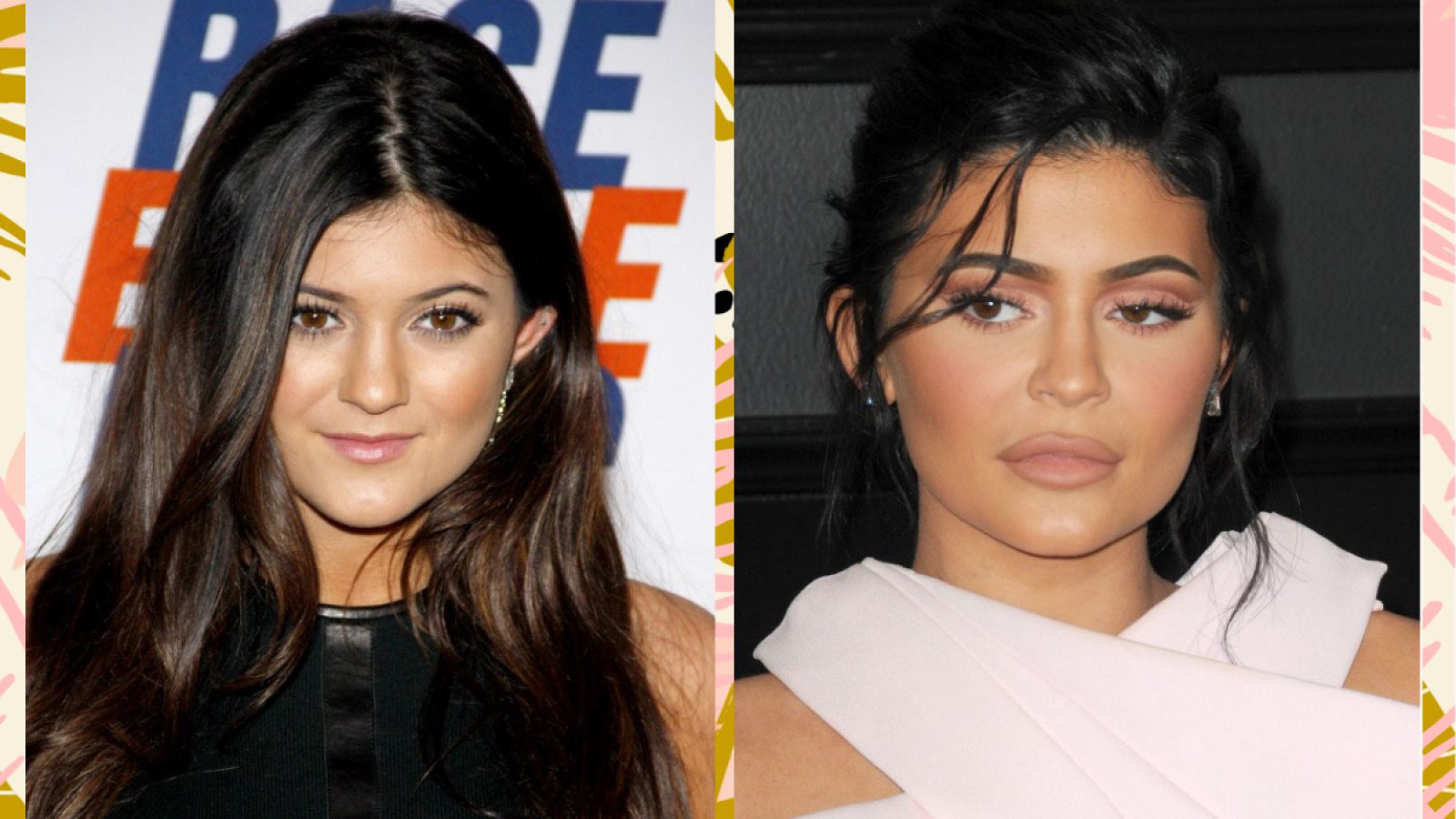 Did Kylie Jenner Get Plastic Surgery? She Says NoHelloGiggles
