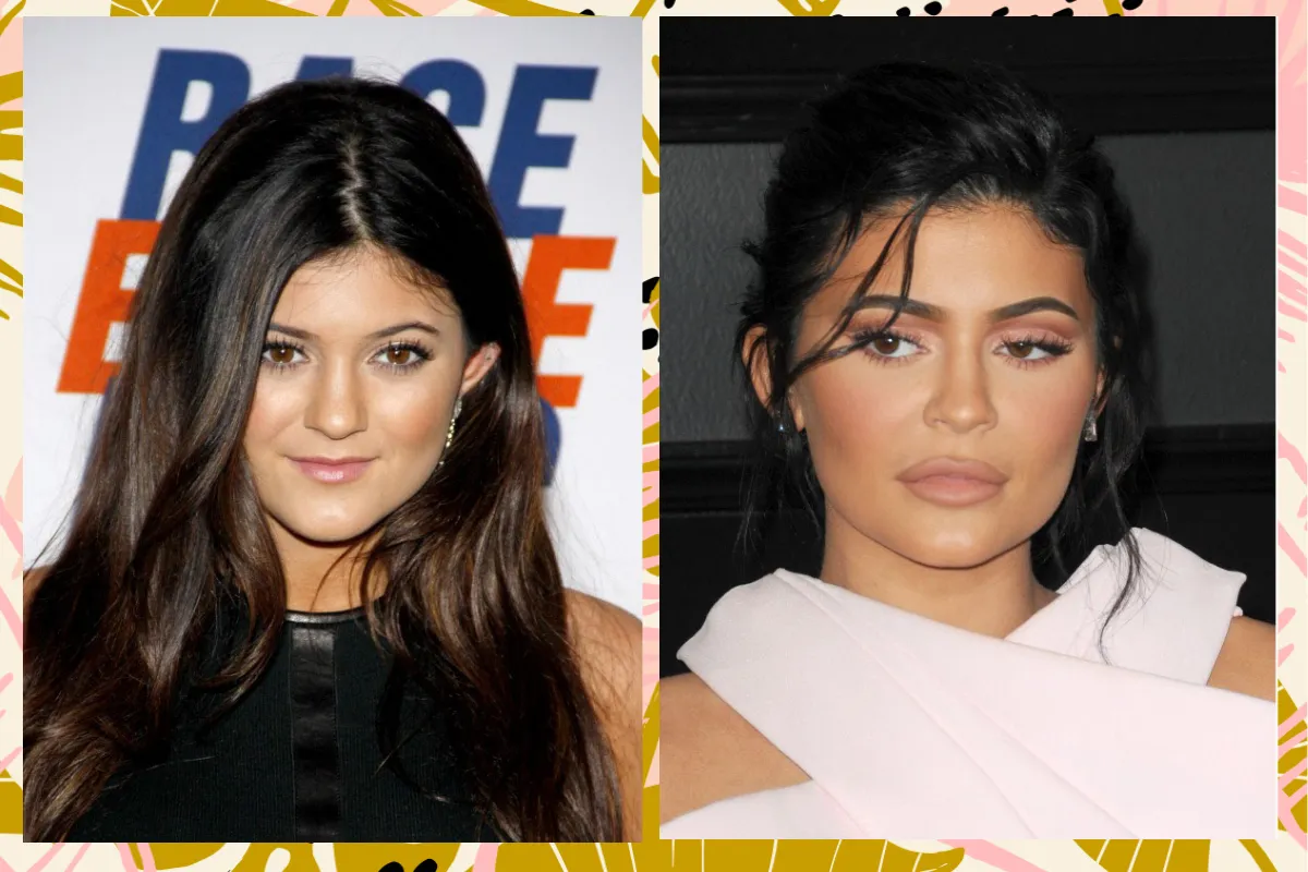 Did Kylie Jenner Get Plastic Surgery? She Says NoHelloGiggles