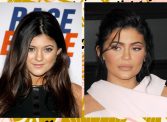 Kylie Jenner Plastic Surgery Controversy