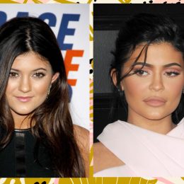 Kylie Jenner Plastic Surgery Controversy
